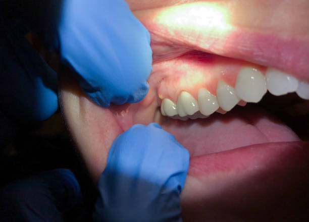 Best Walk-In Emergency Dentist in Tallapoosa, GA